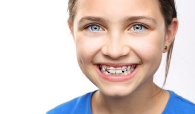 Çocuklar da Ortodontik Diş Sorunlarına Dikkat! 