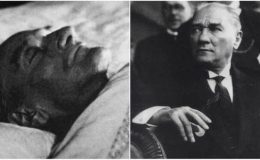 Ulu Önder Atatürk’ün Hastalığı: Siroz