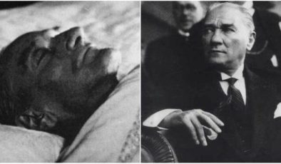Ulu Önder Atatürk’ün Hastalığı: Siroz