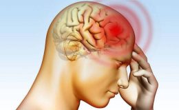 Beyin Damar Tıkanıklığı Nedir? Belirtileri ve Tedavisi