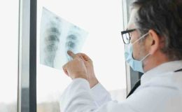 Akciğer Kanseri Nedir? Akciğer Kanseri Belirtileri