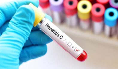 Hepatit C Nedir? Nasıl Bulaşır? Belirtileri Nelerdir?