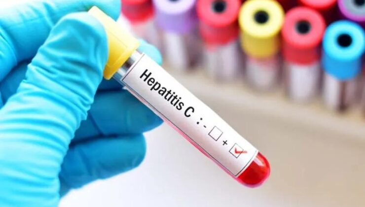 Hepatit C Nedir? Nasıl Bulaşır? Belirtileri Nelerdir?