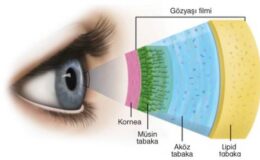 İleri Yaşta Kırmızı Et Gözü Bozuyor