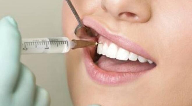 Diş Çekimi İle İlgili Komplikasyonlar