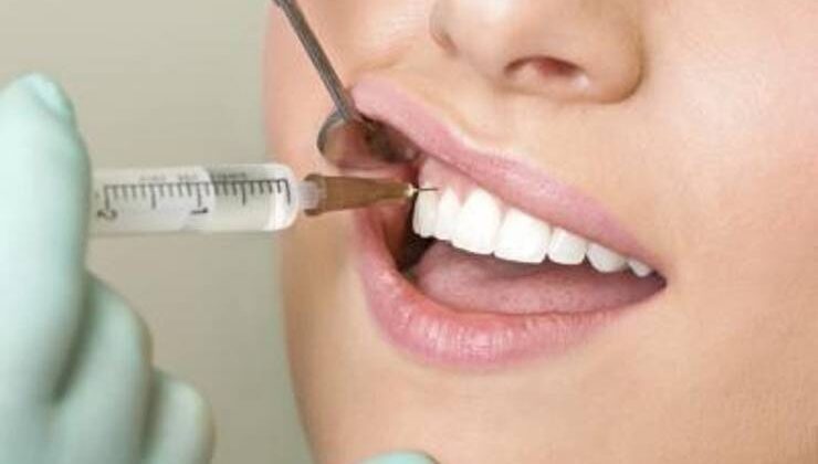 Diş Çekimi İle İlgili Komplikasyonlar
