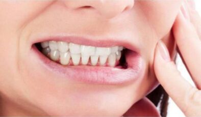 “Diş Gıcırdatma” ve Tedavi Yöntemleri