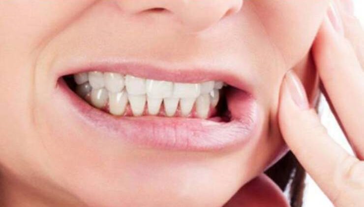 “Diş Gıcırdatma” ve Tedavi Yöntemleri