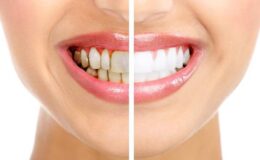 Diş ve Diş Sağlığı – Dev Arşiv