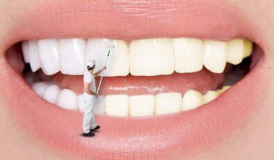 Dişleri beyazlatmanın 2 yolu