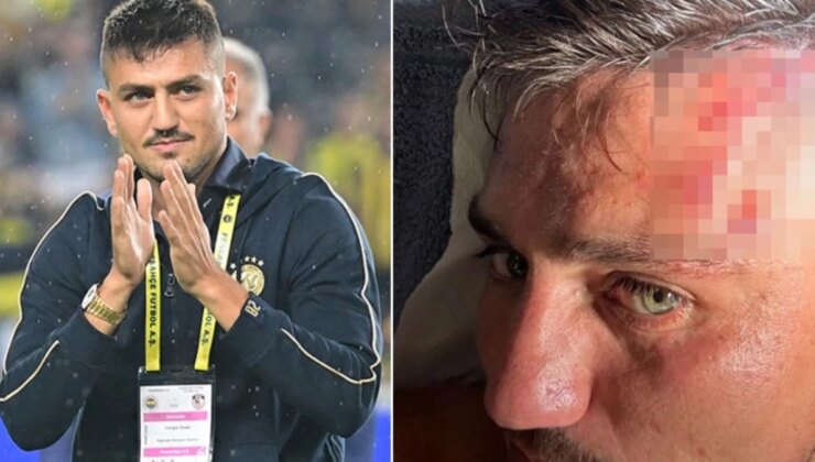 Fenerbahçe’nin yeni yıldızı Cengiz Ünder, kanlar içinde kaldı! Son halini paylaşıp, “Hoş bulduk” dedi