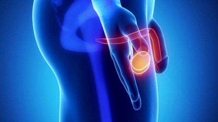 Varikosel hidrosel spermatosel orşit epididimit testis tümörleri