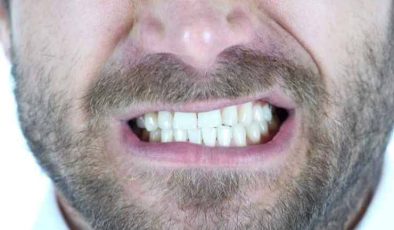 Diş Gıcırdatması ve Tedavi Yöntemi