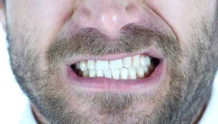 Diş Gıcırdatması ve Tedavi Yöntemi