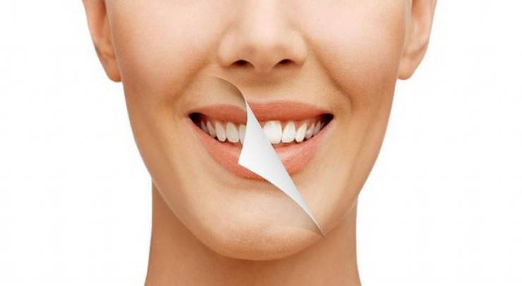 Dişlerinizi beyazlatan gıdalar