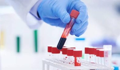 Kansere karşı hangi kan testlerini yaptırmak gerekir?