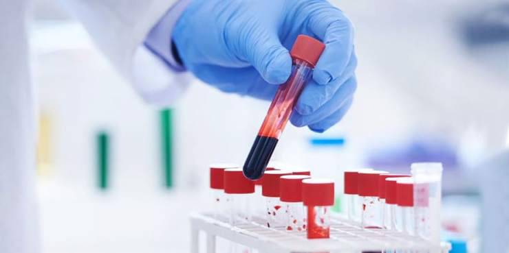 Kansere karşı hangi kan testlerini yaptırmak gerekir?