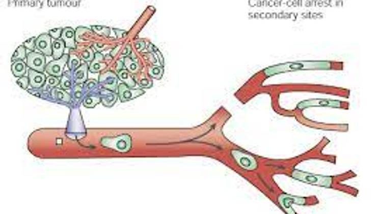 Antineoplastik Ve Immün Sistemi Etkileyen Ilaçlar Arasındaki Etkileşimler