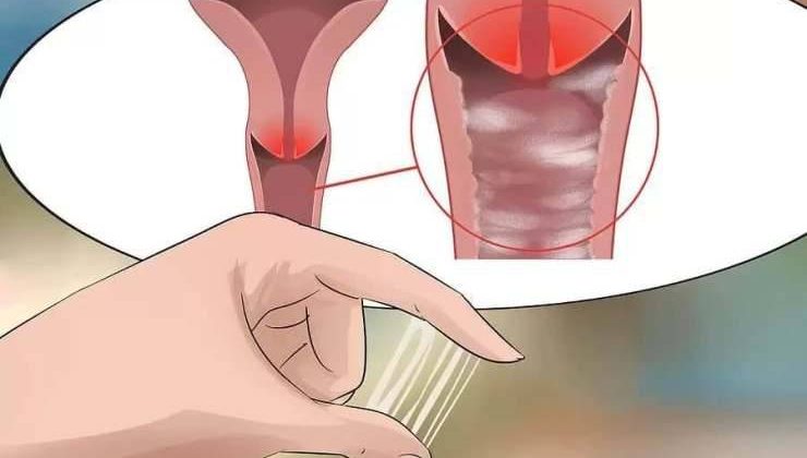 Vaginal akıntılar ve vaginitis