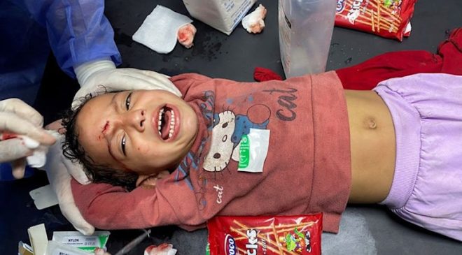 Gazze’de anestezisiz ameliyatlar… ‘Ya bu acıyı çekecekler ya da ölecekler’