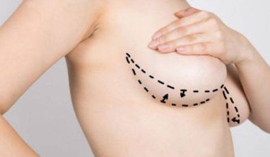 Büyük Göğüsleri Küçültmek Ve Deriyi Canlandırarak Gevşemesini Önlemek İçin