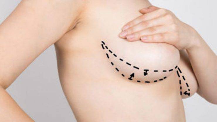 Büyük Göğüsleri Küçültmek Ve Deriyi Canlandırarak Gevşemesini Önlemek İçin