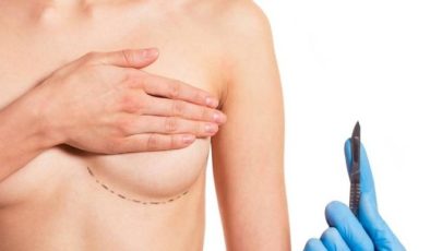 Göğüs Büyütme (Breast Augmentation)