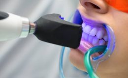 Diş Beyazlatma Operasyonu Nedir?