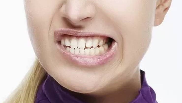 Diş Gıcırdatmayı Engelleme Yolları