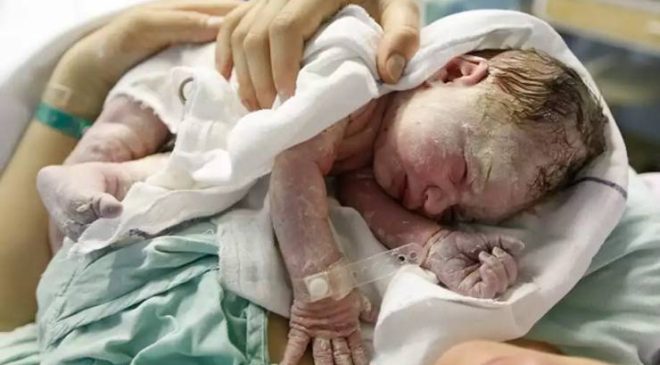 Doğum sırasında bebekte oluşan zararlar, doğum travmaları