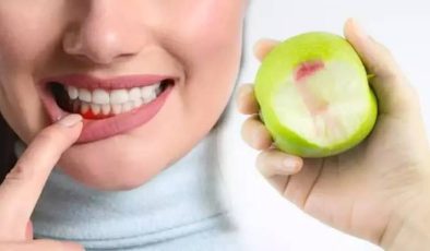 Elma sirkesi ile Dişler Sağlıklı olsun