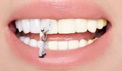 Evde Yapabileceğiniz Diş Beyazlatma Yöntemleri