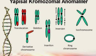 Sayısal Kromozom Bozuklukları