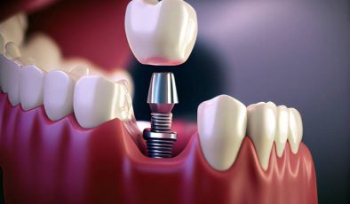 Eksik Diş Sağlığı İçin Büyük Tehlike