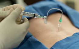 Epidural Anestezi (Ağrısız Doğum)