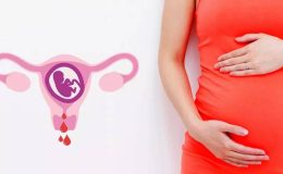 Hamilelik Süresinde Oluşan Kanamalar