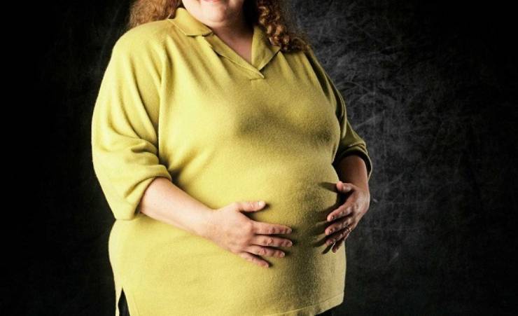Obezite Cerrahisi ile Yeni Bir Hayata Merhaba
