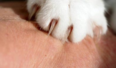 Cat Scratch Disease (Kedi Tırmığı Hastalığı)