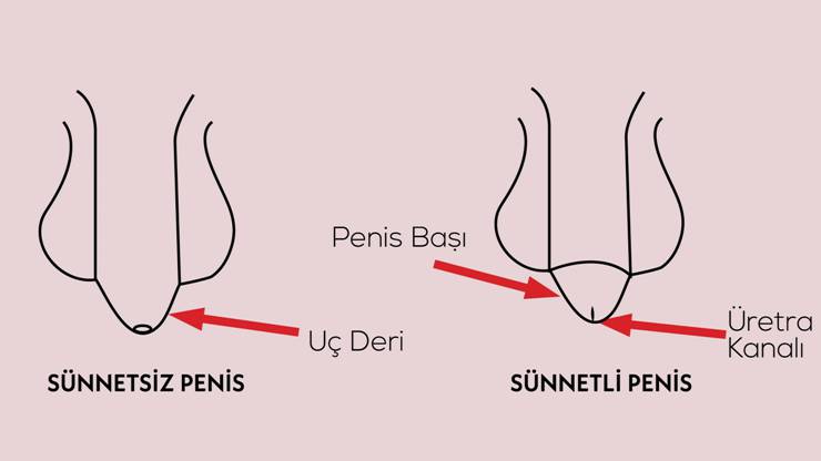 Sünneti cinsel travma olarak algılıyorlar