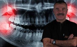 Yirmilik dişler ihmale gelmiyor! Uzmanı uyardı: GÜLÜŞÜNÜZ BOZULABİLİR