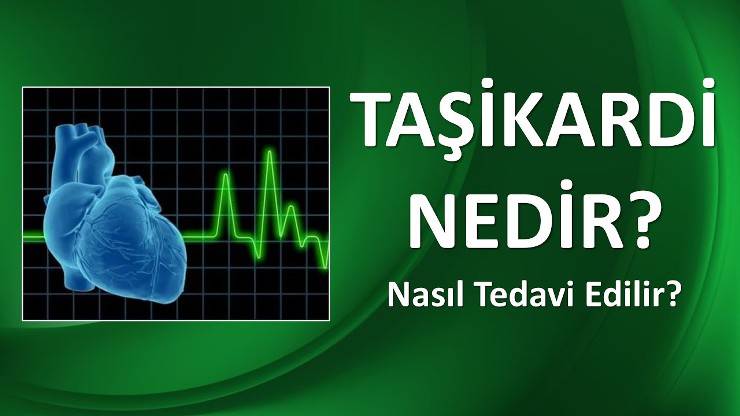 Taşikardi