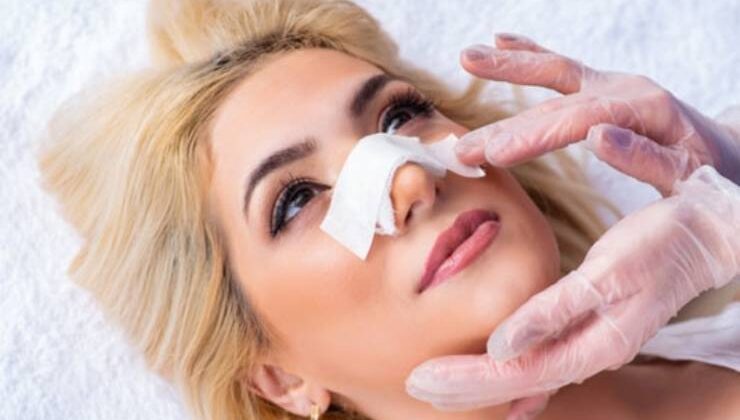 Burun Estetik Ameliyatı Sonrası
