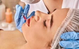 Dolgu Maddeleri – Restylane