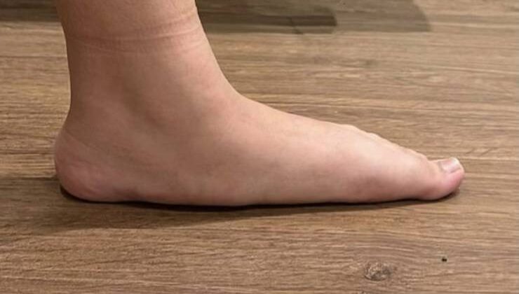 Düz Tabanlık Çukur Tabanlık
