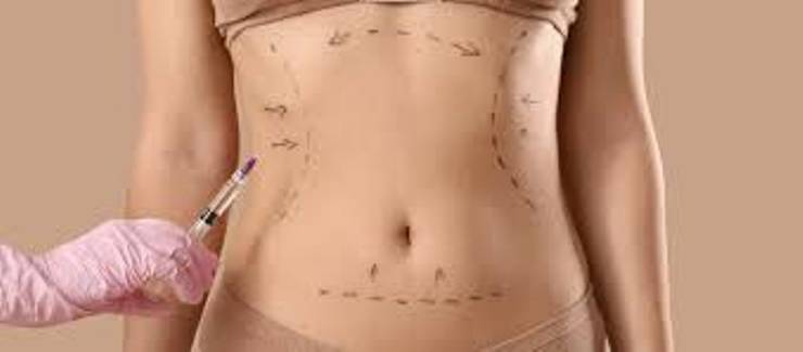Liposuction dost mu, düşman mı?
