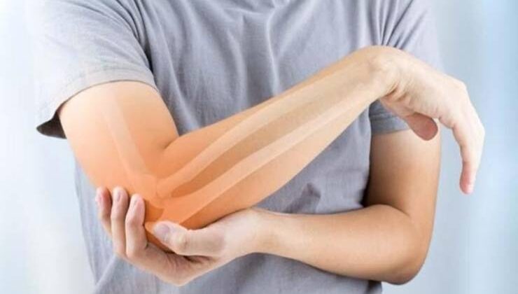 Ulnar sinir sıkışması