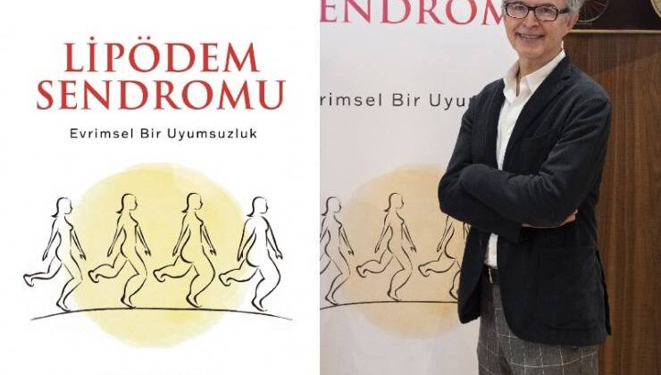 “Diyet Yapıyorum Yüzüm Çöküyor Ama Bacaklarım İncelmiyor” Diyorsanız Dikkat!