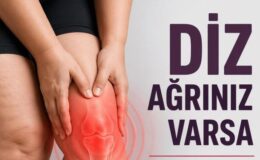Diz Ağrınız Varsa Lipödem Olabilirsiniz