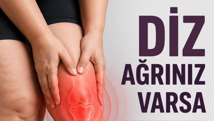 Diz Ağrınız Varsa Lipödem Olabilirsiniz