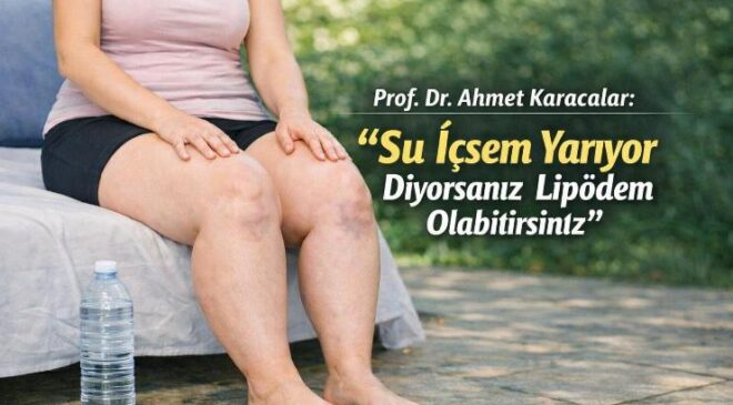 Prof. Dr. Ahmet Karacalar: “Su İçsem Yarıyor Diyorsanız Lipödem Olabilirsiniz”